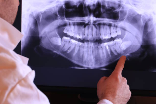 Best Emergency Tooth Extraction in Rush Springs, OK
