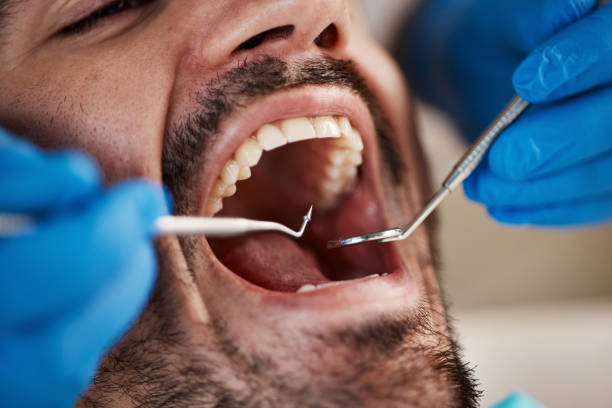 Best Emergency Treatment for Dental Infections or Abscesses in Rush Springs, OK