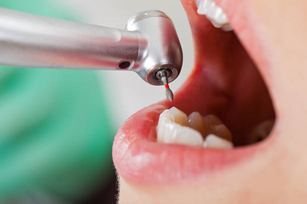 Best Emergency Gum Treatment in Rush Springs, OK